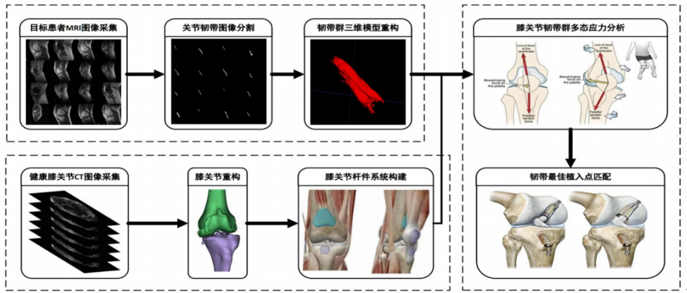 膝关节韧带群植点中心定位系统项目图示