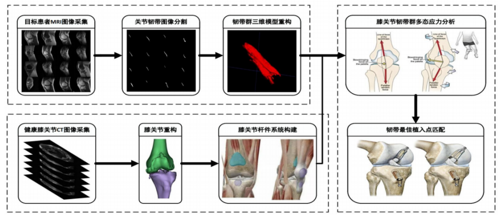 膝关节韧带群植点中心定位系统项目图示